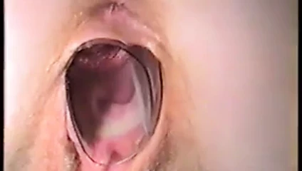 Gigantic Vulva